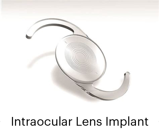 cataract-implant