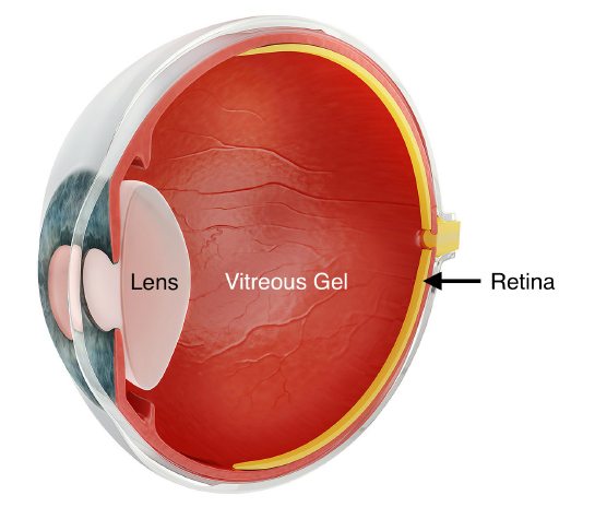 retina-1